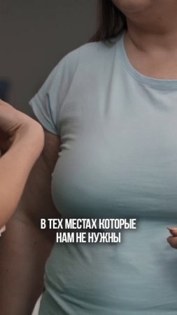 Как ВЕРНУТЬ ПЛОСКИЙ ЖИВОТ?! #медицина #красота #пластическийхирург #врач #пластика #доктор