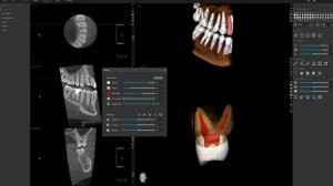 ENDO function