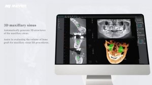 Meyer CT presentation