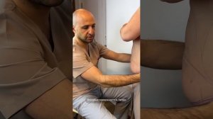 ВЫПОЛНЕНА КОМПЛЕКСНАЯ АБДОМИНОПЛАСТИКА ПО ТЕХНОЛОГИИ 5Б. Доктор Карапетян