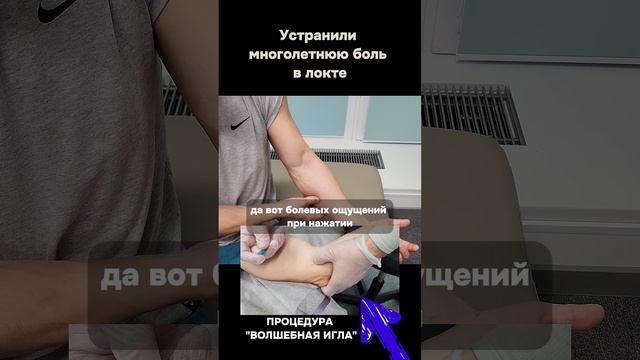 МНОГОЛЕТНЯЯ  БОЛЬ  В ЛОКТЕ ПРОШЛА МОМЕНТАЛЬНО | ВОЛШЕБНАЯ ИГЛА #ЛЕЧЕНИЕ