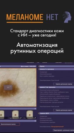 ИИ — новый стандарт качества в дерматоскопии