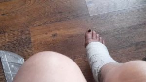 На инвалидной коляске...перелом лодыжки