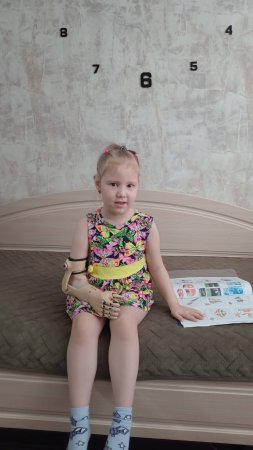Камилла умело пользуется протезом руки