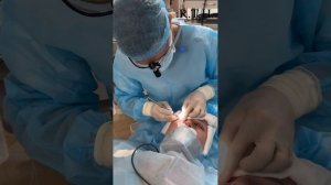 Блефаропластика под местной анестезией. Как проходит?