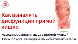 Как выявлять дисфункции прямой кишки. Ассоциированная мышца с прямой кишкой