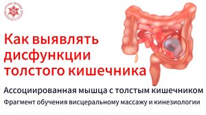 Как выявлять дисфункции толстого кишечника. Ассоциированная мышца с толстым кишечником