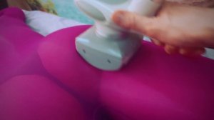 LPG коррекция фигуры