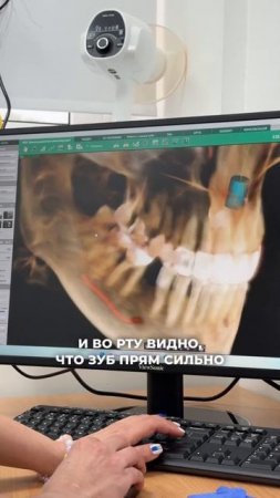 Взрослые пациенты в клинике Столица! ❤️ Стоматология “СТОЛИЦА”  Москва