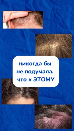 бегите проверьте свою расческу🫧