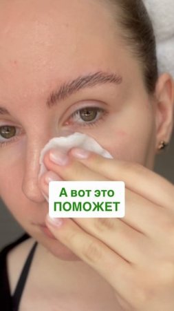 Как избавиться от прыщей