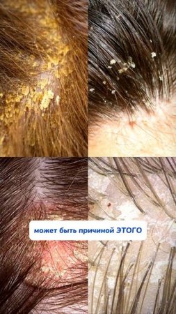 WB #93550775  OZ #655295171 
Очищайте свои расчески правильно! Отлично подходит чудо-очиститель