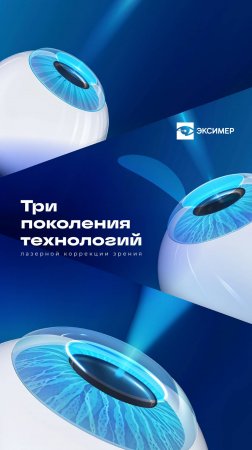 Методы лазерной коррекции зрения в Эксимер.