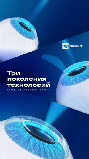 Методы лазерной коррекции зрения в Эксимер.