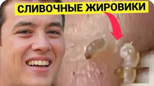 Сливочные ЖИРОВИКИ Собраны в Мега-Нарезку. Залипательный Релакс по Чистке Кожи
