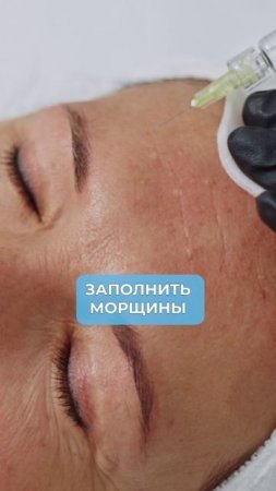 Коллагеностимуляция: ПОМОГАЕТ или ВРЕДИТ коже? #коллаген #коллагеностимуляция #уходзакожей