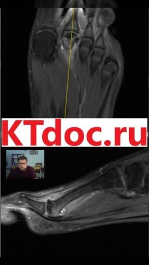 Келлер_2