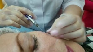 Комплексная коррекция возрастных изменений