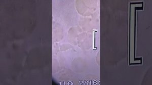 Глаза в глаза смотрим  на возбудителя! (метосепт , витанорм и метов., артромакс при артритах, остеох