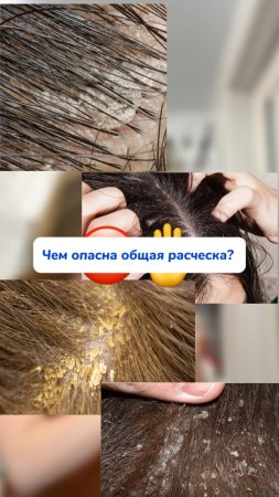 Чем опасна общая расческа?