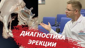 Диагностика эрекции / Доктор Черепанов