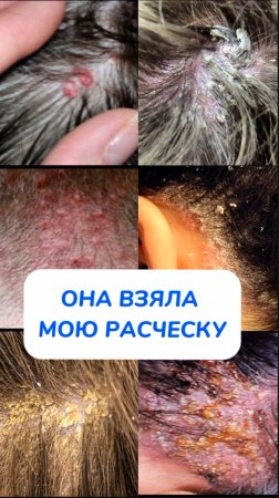 а ты так делаешь? Арт. на очиститель WB #93550775 Ozon #655295171
