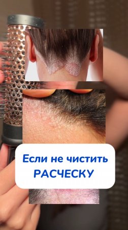 Кислородное спасение WB #93550775 Ozon #655295171