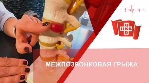 Межпозвонковая грыжа