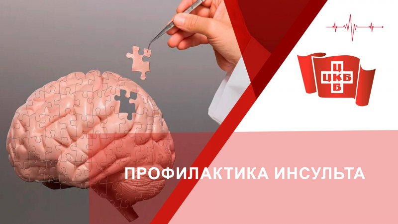 ПРОФИЛАКТИКА ИНСУЛЬТА