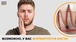 Киста в зубе? Как распознать и что делать