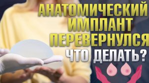 Может ли перевернуться анатомический имплантат? / Пластический хирург Сергей Свиридов