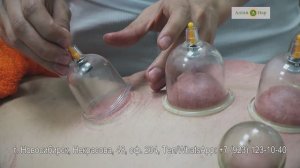 Баночный массаж. Обучение в академии АлтанНар