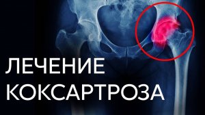 Амбулаторная хирургия суставов | Доклад И.К. Ерёмина (Чебоксары 2025)
