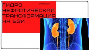 Гидронефроз  на УЗИ