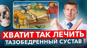Избавься от БОЛИ в тазобедренном суставе НАВСЕГДА! Что делать если болит тазобедренный сустав?