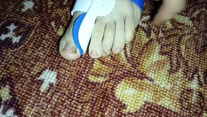 Корректировщик большого пальца на ноге.mp4