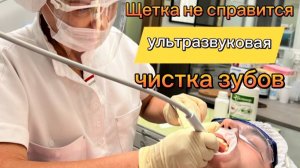 Ультразвуковая чистка зубов