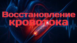 Нужно расширять сосуды — это опасно? | Стентирование, таблетки