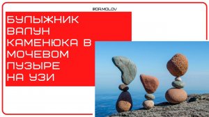 Булыжник ЮТ