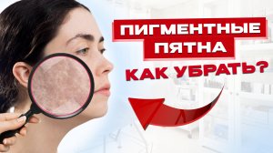 Как УБРАТЬ ПИГМЕНТАЦИЮ?! Топ процедур у косметолога