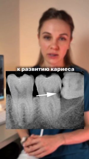 Восьмёрки: друг или враг? Разбираемся в нюансах! 🦷