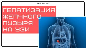 Гепатизация желчного пузыря на УЗИ брюшной полости