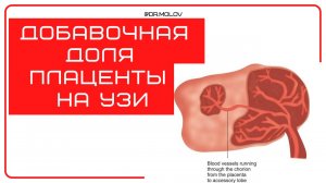 Добавочная плацента