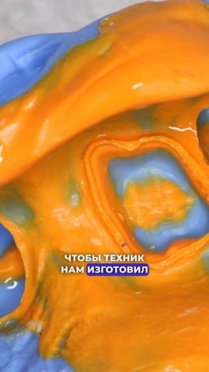 Острая боль у пациента! ❤️ Стоматология “СТОЛИЦА”  Москва