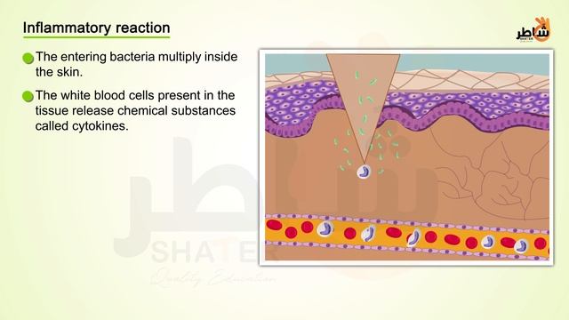Non-specific immune response  Specific immune response