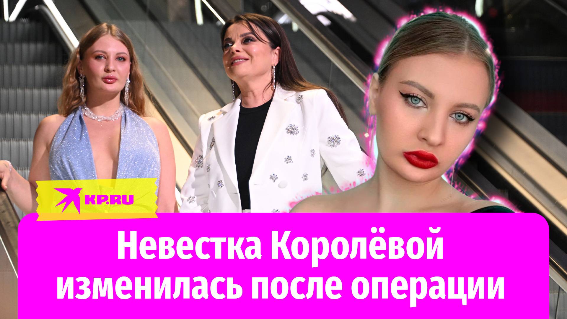«Срезали верхнюю челюсть»: как изменилась невестка-стриптизёрша Наташи Королёвой после операции