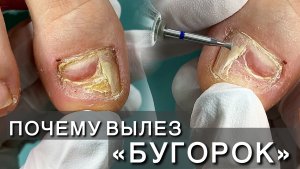 Прищемила