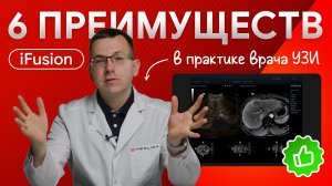 Технология iFusion: 6 преимуществ и применение функции на практике