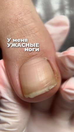 А вам тоже кажется, что ваши стопы — самые страшные? 😅 ⠀