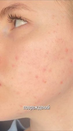 Польза АЛЛАНТОИНА 🤯 крем, в составе которого есть аллантоин - арт wb: 24764471